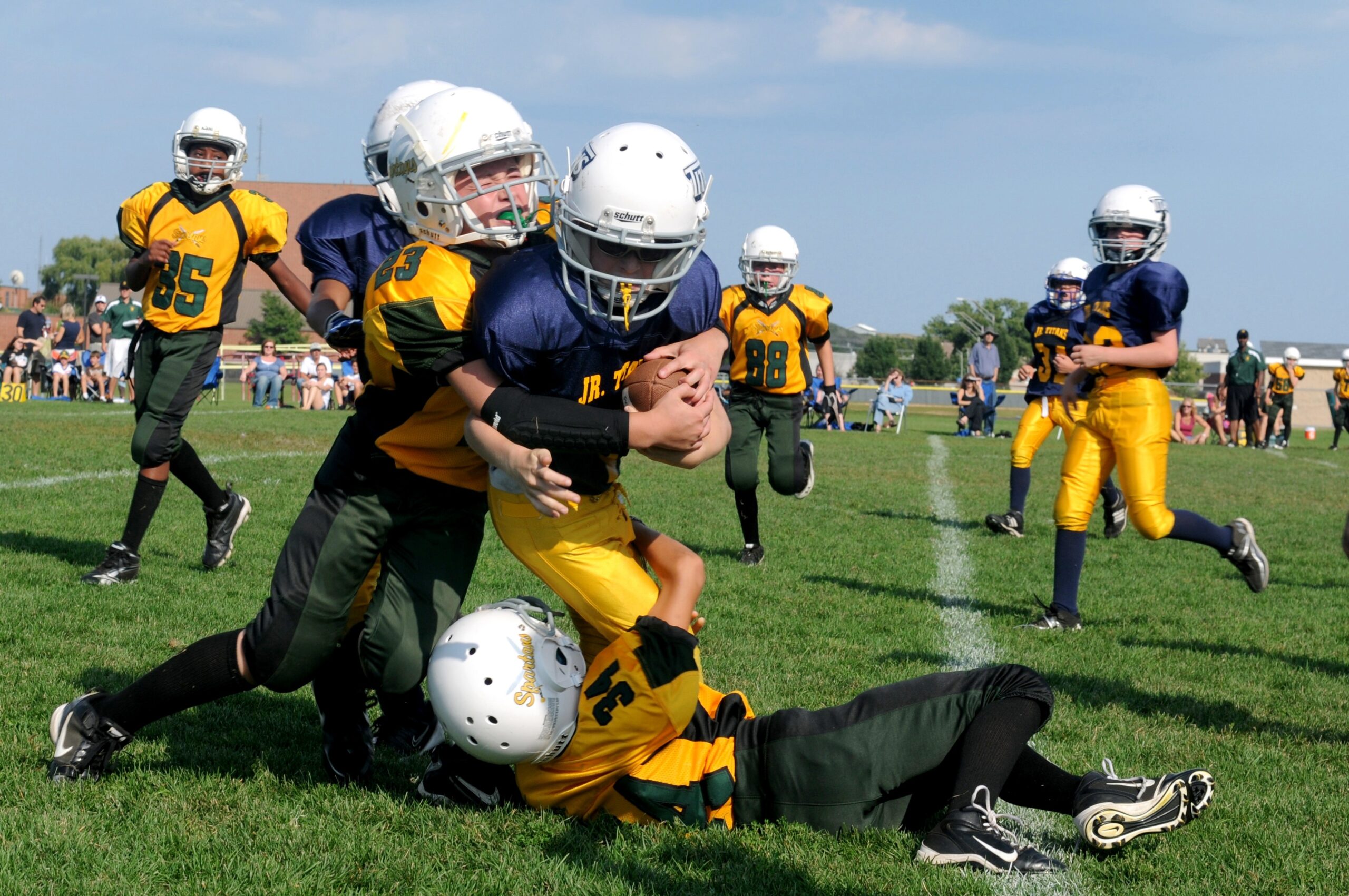 Concussions: Why PT is Crucial for Treatment and Recovery